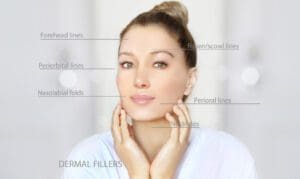 Woman-with-smooth-skin-showing-where-dermal-fillers-and-BOTOX®-can-be-injected