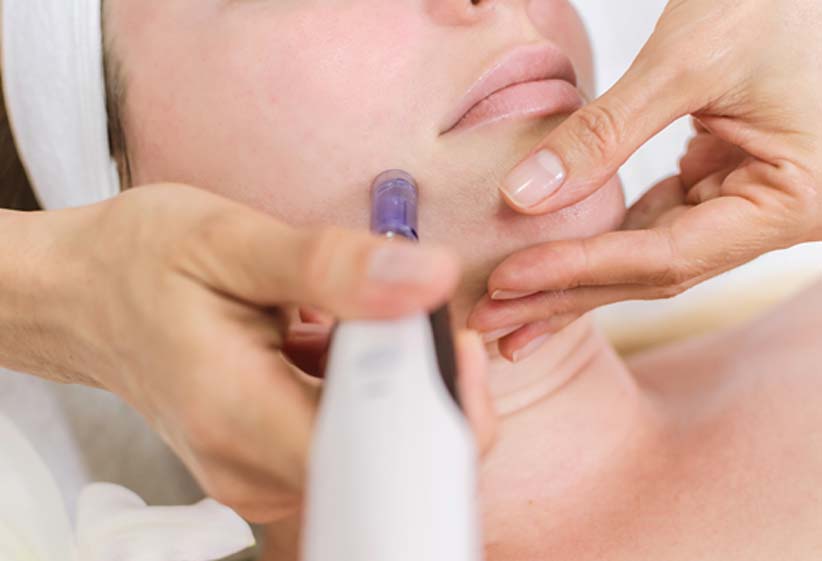 appointment-for-micro-needling-in-Irvine-New-Skin-Body-Aesthetics