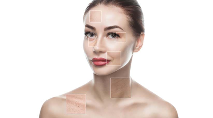 areas-targeted-by-IPL-facial-in-Irvine-New-Skin-Body-Aesthetics