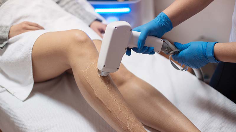 treatment-on-legs-at-a-laser-hair-removal-clinic-in-Irvine-New-Skin-Body-Aesthetics