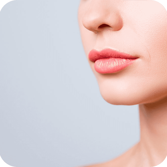 Women-with-beautiful-lips-after-Restylane-Kysse